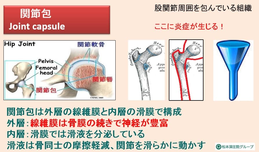 関節包の図